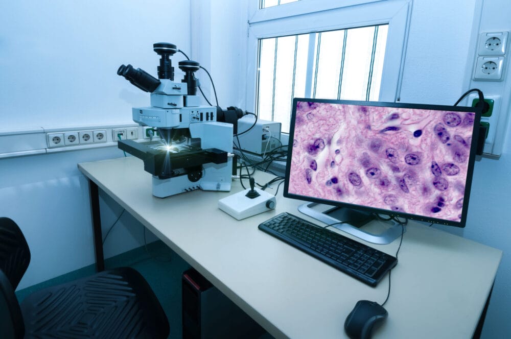 A pathologist at a microscope station reviewing a tissue sample on screen